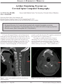 Cover page: Artifact Simulating Fracture on Cervical Spine Computed Tomography