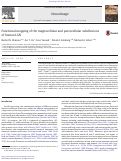 Cover page: Functional mapping of the magnocellular and parvocellular subdivisions of human LGN