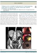 Cover page: Utilization of an overtube for placement of a lumen-apposing metal stent for removal of a capsule endoscope retained proximal to an ileal stricture