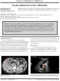 Cover page: Pseudo-duplication of the Gallbladder