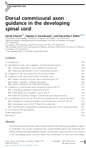 Cover page: Dorsal commissural axon guidance in the developing spinal cord
