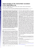 Cover page: Optical imaging of the chorioretinal vasculature in the living human eye.