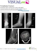 Cover page: Trimalleolar Fracture