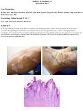 Cover page: Verrucous epidermal nevus