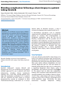 Cover page: Bleeding complication following a shave biopsy in a patient taking ibrutinib