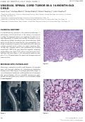 Cover page: Unusual Spinal Cord Tumor in A 16‐Month‐Old Child