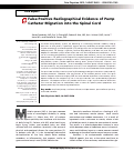 Cover page: False positive radiographical evidence of pump catheter migration into the spinal cord.