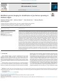 Cover page: Multiblock spectral imaging for identification of pre-harvest sprouting in Hordeum vulgare