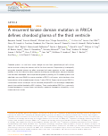 Cover page: A recurrent kinase domain mutation in PRKCA defines chordoid glioma of the third ventricle