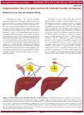 Cover page: Angiopoietin-like 4 in glucocorticoid induced insulin resistance