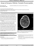 Cover page: Images in Emergency Medicine:  Traumatic Pneumocephalus