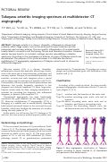 Cover page: Takayasu arteritis: imaging spectrum at multidetector CT angiography