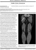 Cover page: Sciatic Artery Aneurysm