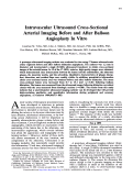 Cover page: Intravascular ultrasound cross-sectional arterial imaging before and after balloon angioplasty in vitro.