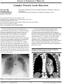 Cover page: Complex Thoracic Aortic Dissection