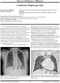 Cover page: Continuous Diaphragm Sign