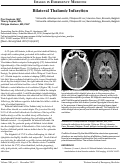 Cover page: Bilateral Thalamic Infarction