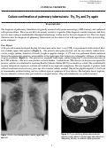 Cover page: Culture confirmation of pulmonary tuberculosis: Try, Try, and Try again