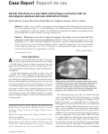 Cover page: Ventral rhinotomy in a pet rabbit (Oryctolagus cuniculus) with an odontogenic abscess and sub-obstructive rhinitis.