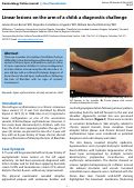 Cover page: Linear lesions on the arm of a child: a diagnostic challenge