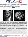 Cover page: Acute Pyelonephritis with Perinephric Stranding on CT