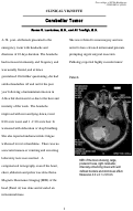 Cover page: Cerebellar Tumor