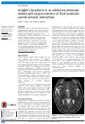 Cover page: Hodgkins lymphoma in an adolescent previously treated with surgical resection of third ventricular juvenile pilocytic astrocytoma.