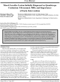 Cover page: Morel-Lavallee Lesion Initially Diagnosed as Quadriceps Contusion: Ultrasound, MRI, and Importance of Early Intervention