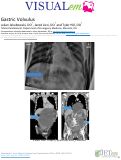 Cover page: Gastric Volvulus