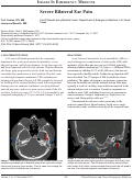 Cover page: Severe Bilateral Ear Pain