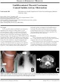 Cover page: Undifferentiated Thyroid Carcinoma Caused Sudden Airway Obstruction