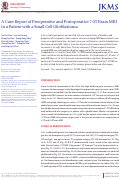 Cover page: A case report of preoperative and postoperative 7.0T brain MRI in a patient with a small cell glioblastoma.