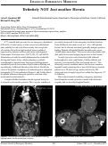 Cover page: Definitely NOT Just Another Hernia