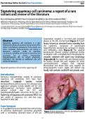 Cover page: Signet-ring squamous cell carcinoma: a report of a rare variant and review of the literature