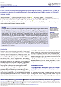 Cover page: Color-coded intravital imaging demonstrates a transforming growth factor-β (TGF-β) antagonist selectively targets stromal cells in a human pancreatic-cancer orthotopic mouse model