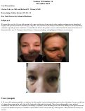 Cover page: Hemifacial atrophy