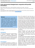 Cover page: Cutis marmorata telangiectasia congenita with painful ulcerations