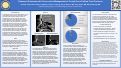 Cover page of Treatment Outcomes with Conservative Management of Frontal Sinus Outflow Tract Fractures