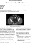 Cover page: A Food Impaction in Crohn’s Ileal Stricture