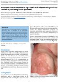 Cover page: Acquired Darier disease in a patient with metastatic prostate cancer: a paraneoplastic process?