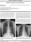 Cover page: Bilateral Spontaneous Pneumothorax