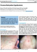 Cover page: Circumscribed palmar hypokeratosis