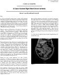 Cover page: A Case of Isolated Right Sided Colonic Ischemia