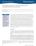 Cover page: VITT following Ad26.COV2.S vaccination presenting without radiographically demonstrable thrombosis