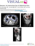 Cover page: Bezoars: An Interesting Case of Abdominal Pain