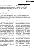 Cover page: Circumferential type A aortic dissection and intimal intussusception of the aorta causing severe aortic regurgitation and obstruction of the left main coronary artery.