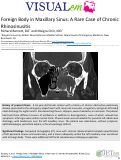 Cover page: Foreign Body in Maxillary Sinus: A Rare Case of Chronic Rhinosinusitis