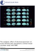 Cover page: The analgesic effect of electroacupuncture on acute thermal pain perception-a central neural correlate study with fMRI