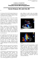 Cover page: Postpartum Severe Mitral Regurgitation