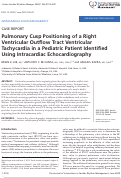 Cover page: Pulmonary Cusp Positioning of a Right Ventricular Outflow Tract Ventricular Tachycardia in a Pediatric Patient Identified Using Intracardiac Echocardiography.